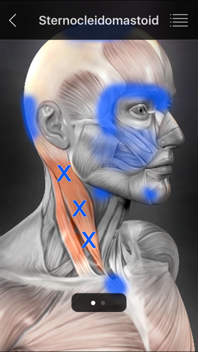 Muscle Trigger Point Anatomy screenshot