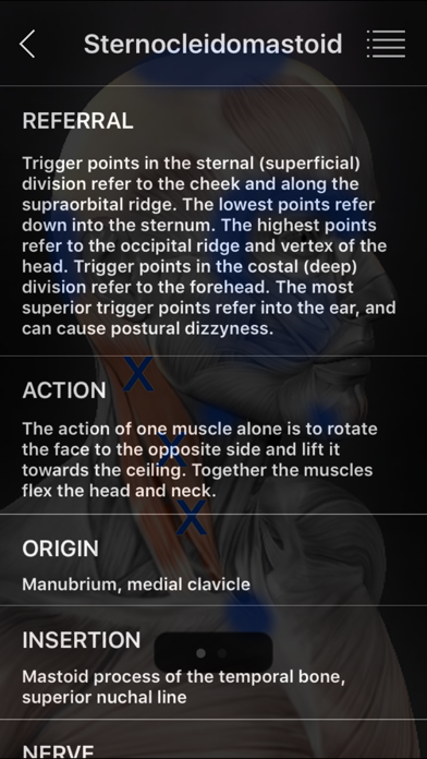 Muscle Trigger Point Anatomy screenshot